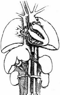 Рисунок, демонстрирующий печень, селезенку, почки, аорту и почечные артерии